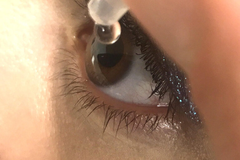 Dry Eye droplet treatment