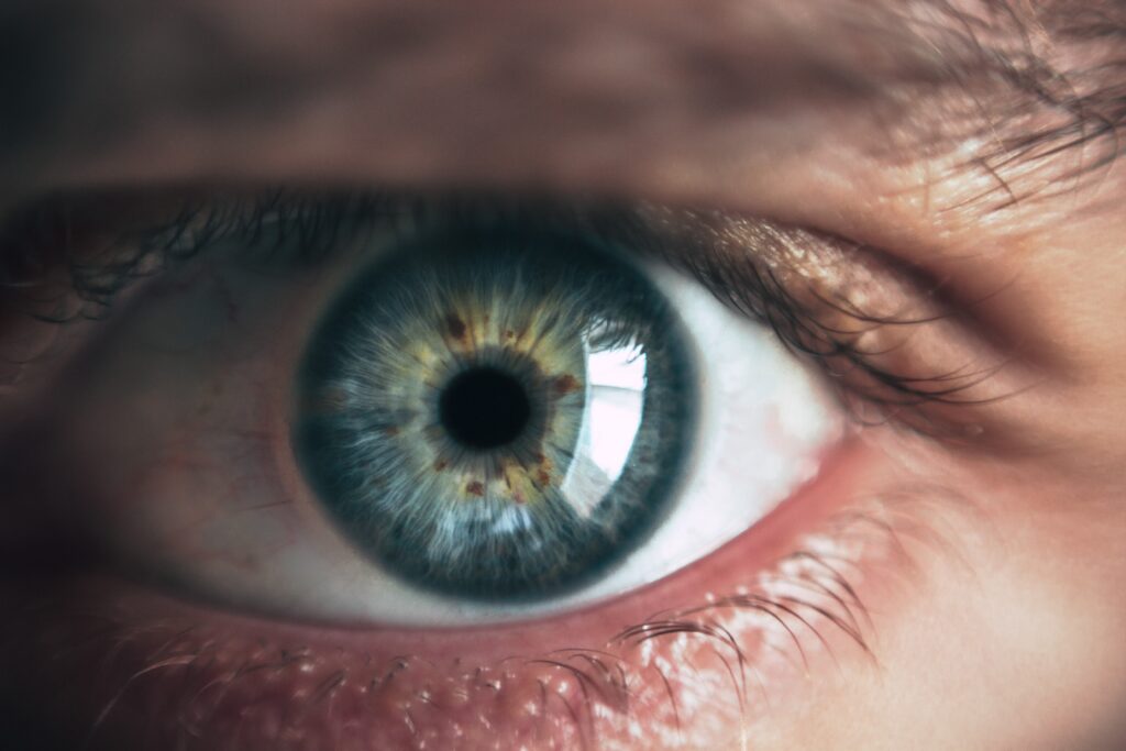 eye conditions