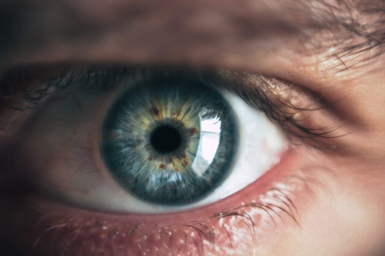 eye conditions