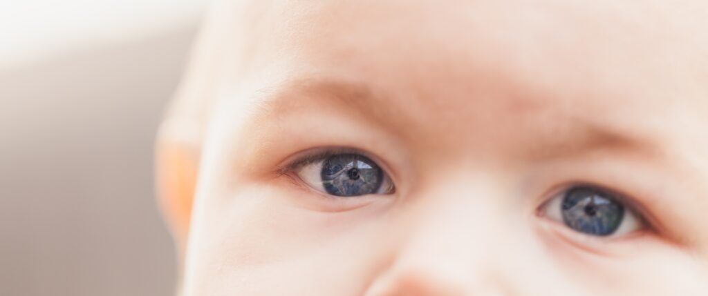 childrens eye conditions