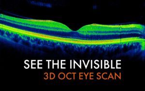 3D OCT Eye Scan