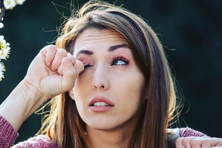 Woman itching sore, red eyes.